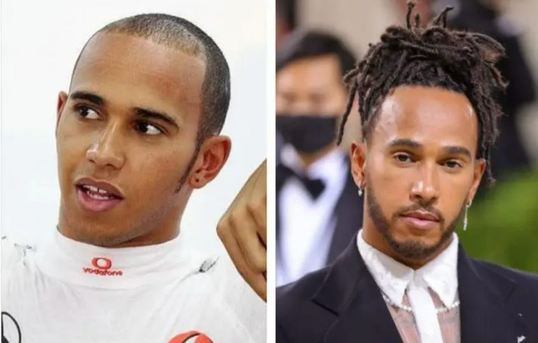 Exploring Lewis Hamiltons Hair Journey: Natural Care or Hair Replacement?