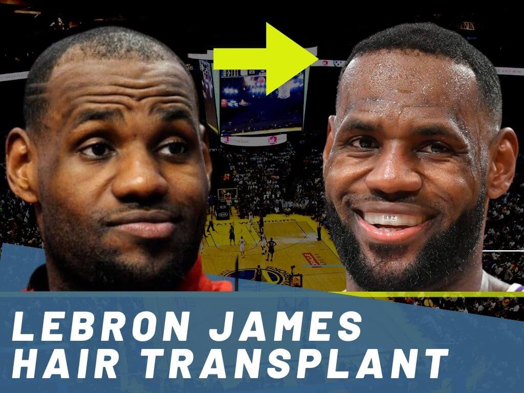 LeBron James Hair Before and After: His Transformation Revealed