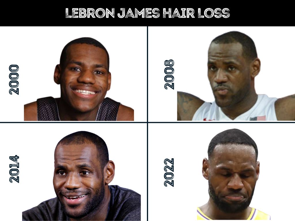 LeBron James Hair Before and After: His Transformation Revealed
