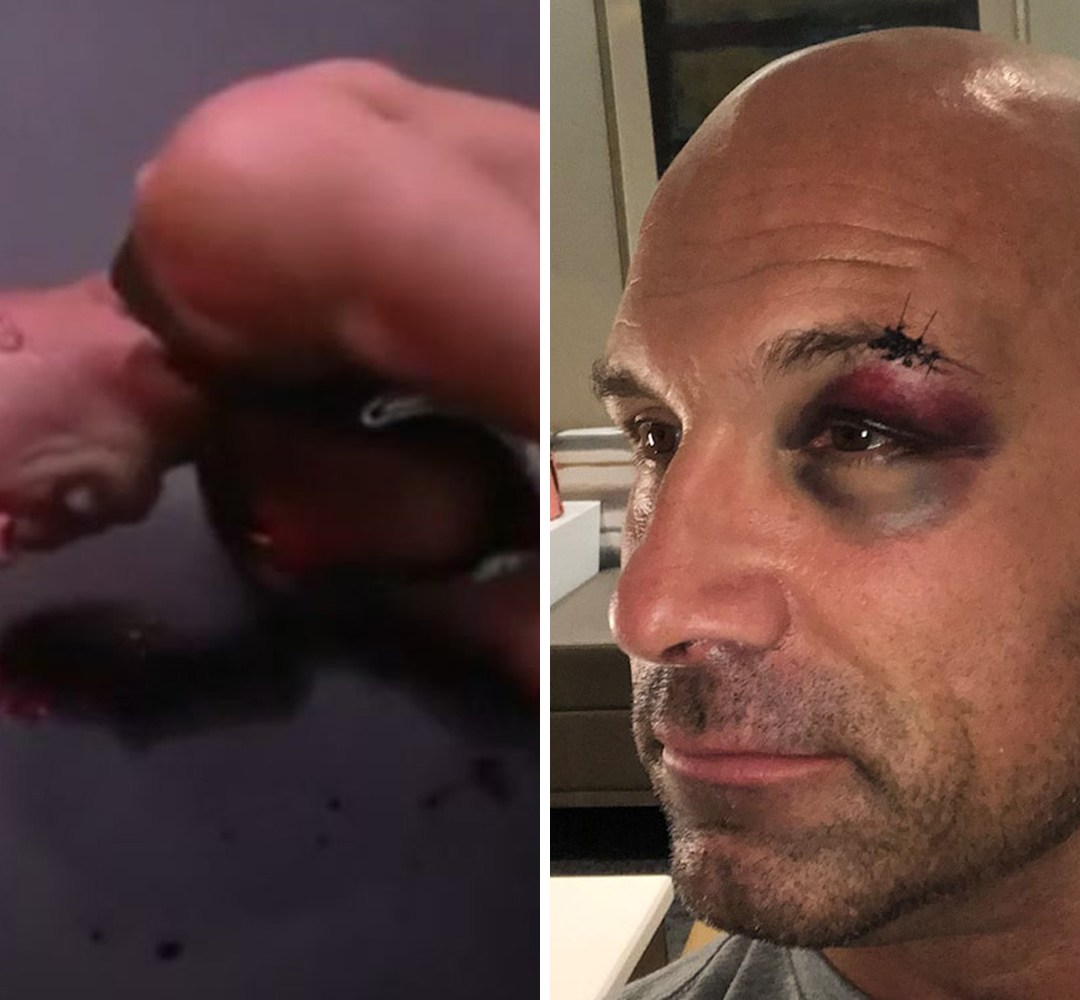 Christopher Daniels Eye Injury: How the AEW Star Is Coping with the Damage