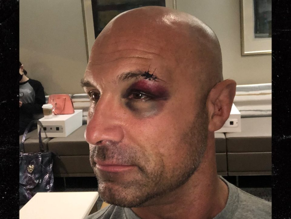 Christopher Daniels Eye Injury: How the AEW Star Is Coping with the Damage
