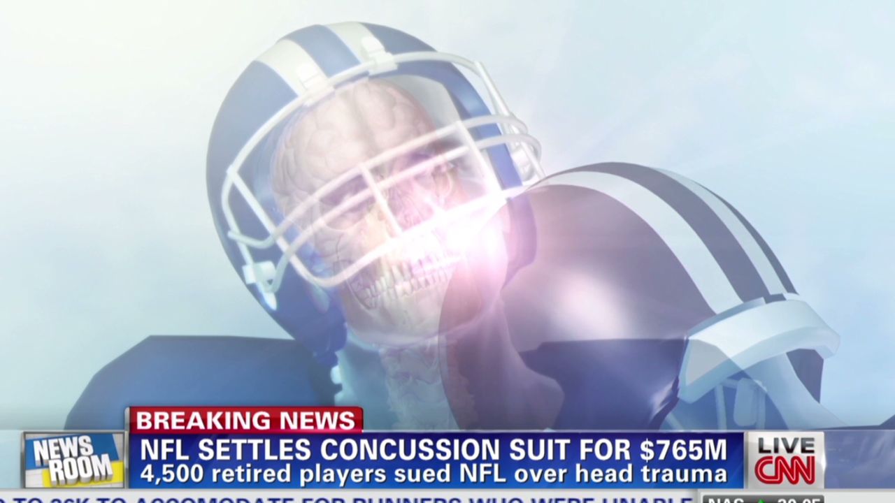 Breaking down NFL injury settlement: how much is an NFL injury settlement for players?